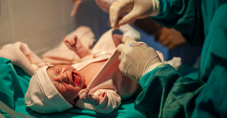 Onrustige baby na keizersnede